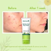 WishCare 2% Salicylic Acid Face Wash | 100ml_img_2