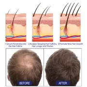 East Moon Hair Growth Foam Hair Deep Repair Roots Hair Follicles Thick Moisturizing Care 60g._img_2