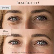 Beauty of Joseon Revive Eye Serum : Ginseng + Retinal 30ml_img_2