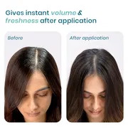Wishcare Air Powder Dry Shampoo for Oily Hair & Scalp - 10g_img_2