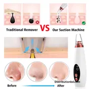 Blackhead Remover_img_3
