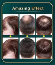 Neo Hair Lotion (Green Wealth)_img_1