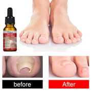 Toenail Pain Relief Kit and Fabric Softener 10ml_img_4
