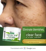 NAPHAHERB GREAN TEA CREAM (melasma cream)_img_2