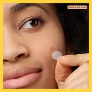 Mighty Patch Original 36pcs Pimple Patch_img_10
