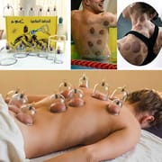 Hijama Cupping Set 12 Pcs – Glass & Plastic Therapy Cups | Sunnah Cupping for Pain Relief, Detox, & Muscle Relaxation | Price in BD_img_2