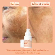 Super Bright Vitamin C16 Serum_img_2