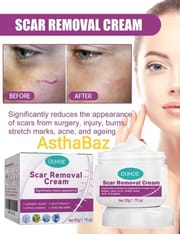 Ouhoe Scar Removing Cream (50g)_img_0