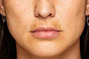 SPOTSRUB ULTRA Cream [Indian] কালো দাগ দূর ও ত্বক ফর্সা করার ক্রিম_img_4