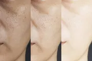 SPOTSRUB ULTRA Cream [Indian] কালো দাগ দূর ও ত্বক ফর্সা করার ক্রিম_img_7