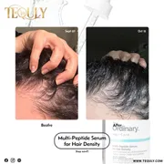 The Ordinary Multi-Peptide Serum for Hair Density 60ml_img_2
