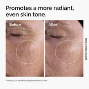 The Ordinary Glycolic Acid 7% Exfoliating Toner 240ml_img_5