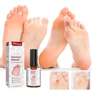 South Moon Foot Corns Exfoliating Gel Hand and Foot Wart Thorn Calluses Skin Smooth Repair and Cleaning 10 ml_img_1