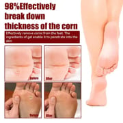 South Moon Foot Corns Exfoliating Gel Hand and Foot Wart Thorn Calluses Skin Smooth Repair and Cleaning 10 ml_img_3