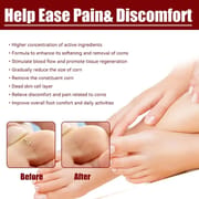 South Moon Foot Corns Exfoliating Gel Hand and Foot Wart Thorn Calluses Skin Smooth Repair and Cleaning 10 ml_img_6