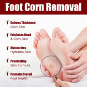 South Moon Foot Corns Exfoliating Gel Hand and Foot Wart Thorn Calluses Skin Smooth Repair and Cleaning 10 ml_img_7