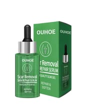 Ouhoe Scar Removal Serum 30 ml_img_1