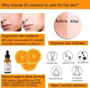 Melao Naturals Vitamin C Facial Serum with Vitamin C 20% E & Hyaluronic Acid_img_6