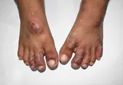 Scrabic Lotion [Indian] শিশুদের জন্য_img_7