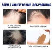 East Moon Hair Growth Foam Hair Deep Repair Roots Hair Follicles Thick Moisturizing Care 60g._img_5