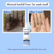 Multi-Peptide Anti Hairfall Shampoo_img_2