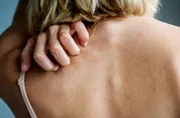 Permimite Lotion [Indian] চুলকানি ধ্বংসকারী এবং উকুননাশক_img_3