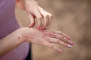 Tarcilic Soap [Indian] একজিমা এবং সোরিয়াসিস নির্মূলে_img_6