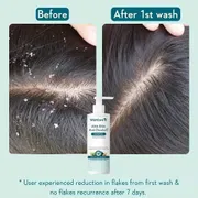 WishCare AHA BHA Anti-Dandruff Shampoo 250ml_img_1