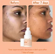 WishCare Super Bright C16 Vitamin C Serum 30ml_img_2