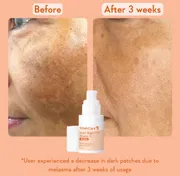 WishCare Super Bright C16 Vitamin C Serum 30ml_img_3