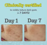Chemist at Play 10% Vitamin C Face Serum 30ml_img_2