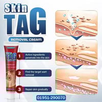 Ethereal Skin Tag Removal Cream_img_1