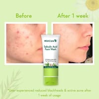 WishCare 2% Salicylic Acid Face Wash | 100ml_img_2