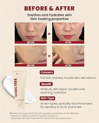 K-SECRET SEOUL 1988 Snail Mucin 93% Cream – Concentrated Yet Lightweight Formula Infused with 93% Snail Mucin | Non-Sticky & Fast-Absorption Facial Cream | Korean Skincare, 100ml / 3.38 fl oz_img_1