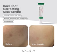 AXIS - Y Dark Spot Correcting Glow Cream[Korean]_img_3