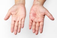 Permimite lotion 2 pcs & scrabic soap 1 pcs_img_11