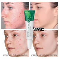 NS4810-Acnee Removal Gel_img_1