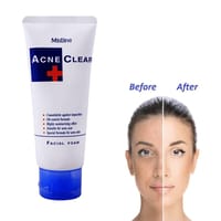 Mistine Acne Clear Facial Foam_img_3