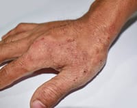 Permefit Lotion [ শক্তিশালী পারমেথ্রিন লোশন ]_img_4