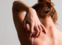 Permefit Lotion [ শক্তিশালী পারমেথ্রিন লোশন ]_img_7