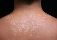 Luliact Soap 75 gm [Indian] দাদ ছুলি দূর করার সাবান_img_8