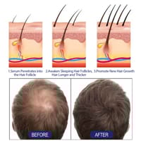 East Moon Hair Growth Foam Hair Deep Repair Roots Hair Follicles Thick Moisturizing Care 60g._img_2