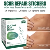 Silicone Gel Scar Patch Roll – Adjustable, Effective Scar Treatment_img_1