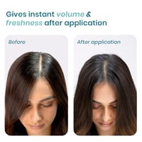 Wishcare Air Powder Dry Shampoo for Oily Hair & Scalp - 10g_img_2