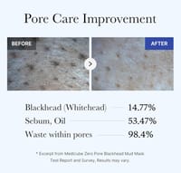 Medicube Zero Pore Blackhead Mud Facial Mask - 100g_img_4