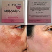 Bioaqua P Vita Melasma Mesta Whitening Cream -10 gm (Thailand)_img_4