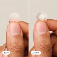 Mighty Patch Original 36pcs Pimple Patch_img_5