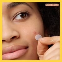 Mighty Patch Original 36pcs Pimple Patch_img_10