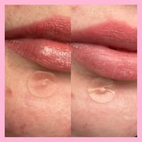 Mighty Patch Original 36pcs Pimple Patch_img_12