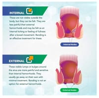 Dictamni Cream [পাইলস চিকিৎসায়]_img_5